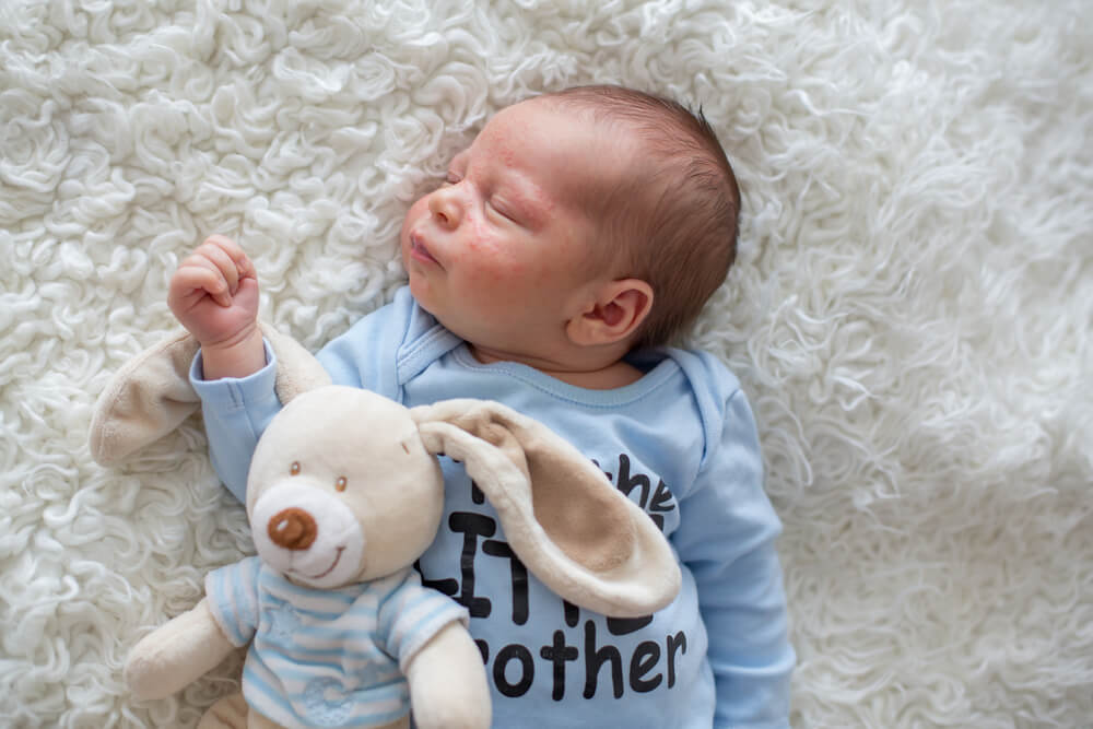 Apa yang harus Diperhatikan untuk Merawat Bayi dengan Kulit Sensitif?