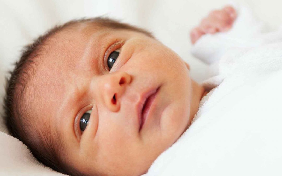 Cradle Cap: Penyebab Ketombe Pada Bayi